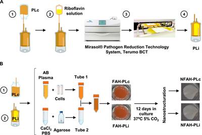 Inactivation of human plasma alters the structure and biomechanical properties of engineered tissues